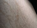 Laminam RARE